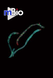 A Myosin Light Chain Is Critical for Fungal Growth Robustness in Candida albicans