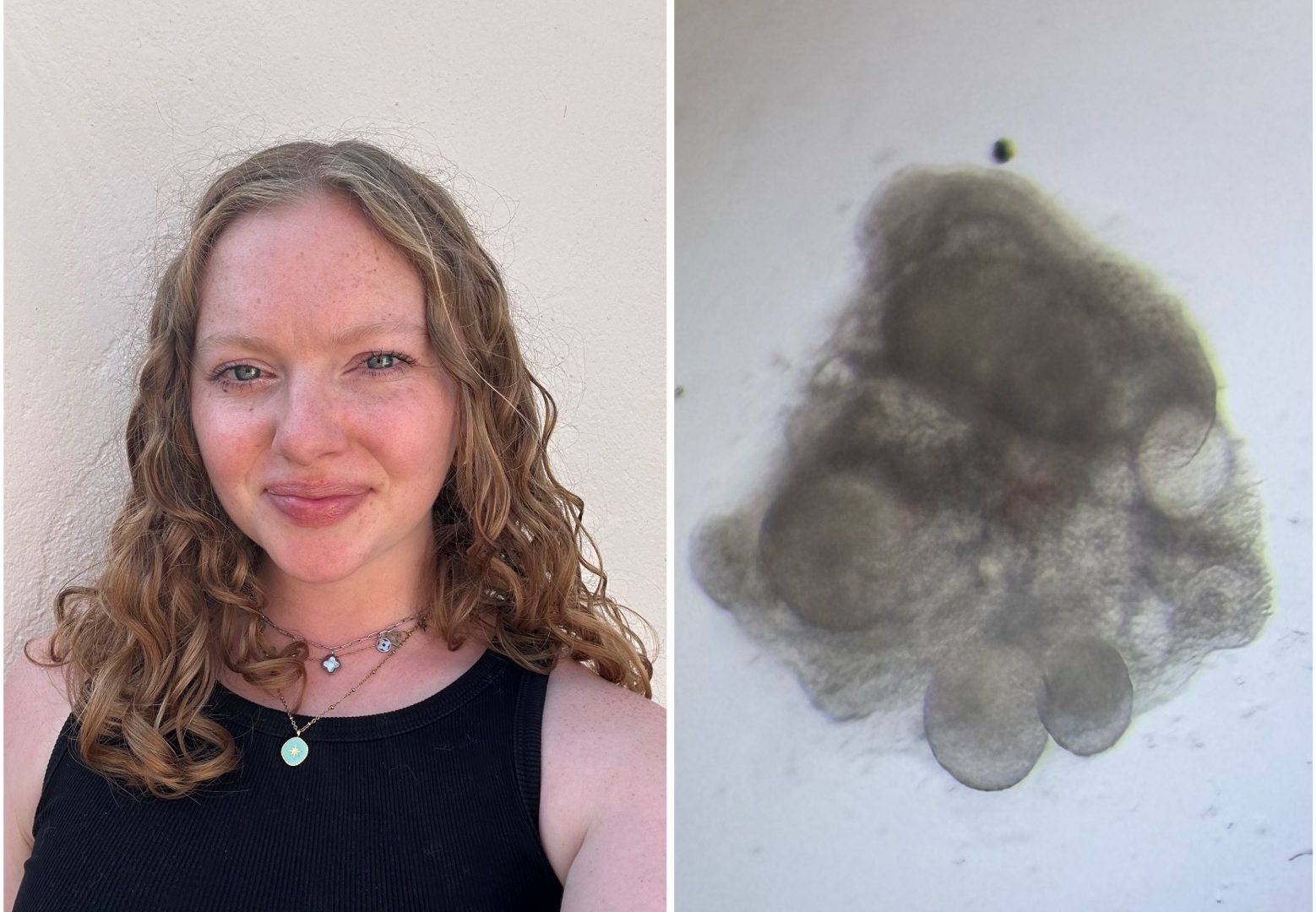 ‘Ex vivo culture of mouse embryonic gonads’, with Lauryane Dubos