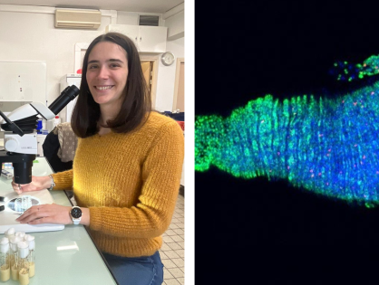 Sex-specific tumor formation in the gut with Charlène Clot