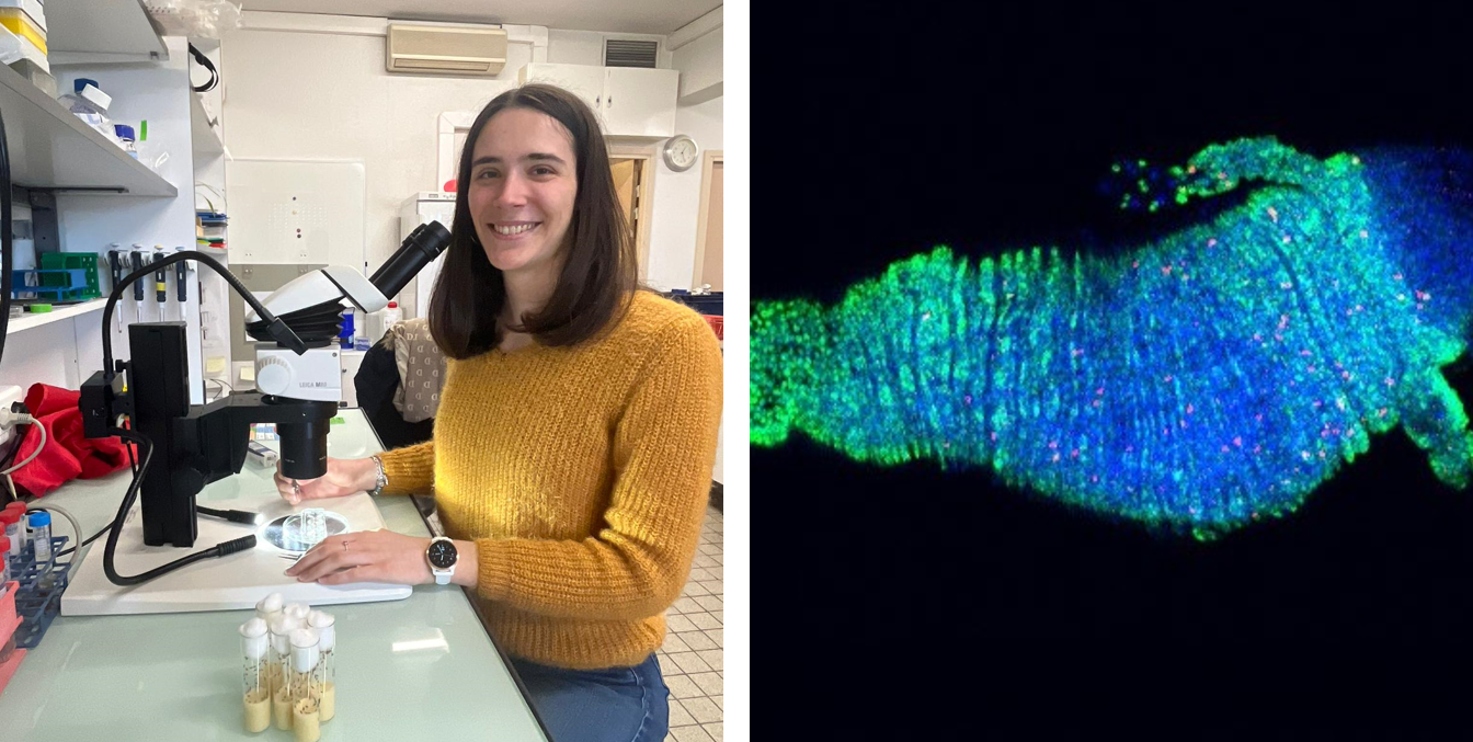 Sex-specific tumor formation in the gut with Charlène Clot