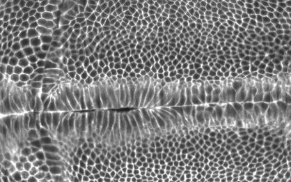 Neither too much nor too little: the embryo must find the right tension to take shape
