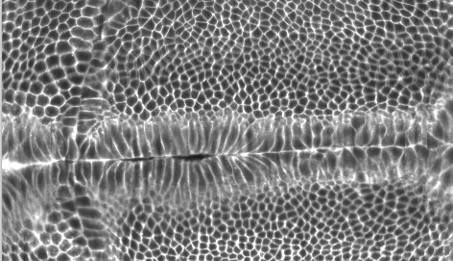 Neither too much nor too little: the embryo must find the right tension to take shape