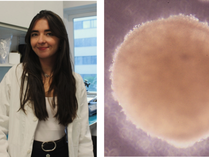 IPS and organoids: defining an adrenal cancer model with Melina Tedesco