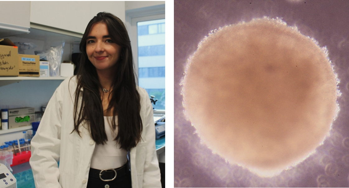 IPS and organoids: defining an adrenal cancer model with Melina Tedesco