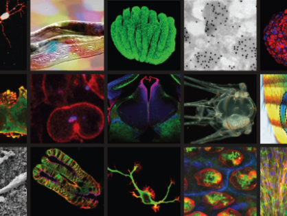 Poste d’Ingénieur d’Études Inserm en Biologie des Organoïdes