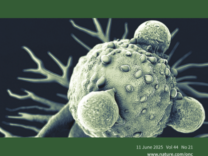 Cancer-associated loss-of-function mutations in KCNQ1 enhance Wnt/β-catenin signalling disrupting epithelial homeostasis
