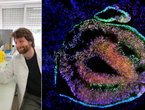 Brain and retinal organoids workshop : applications and challenges with Paolo Piovani