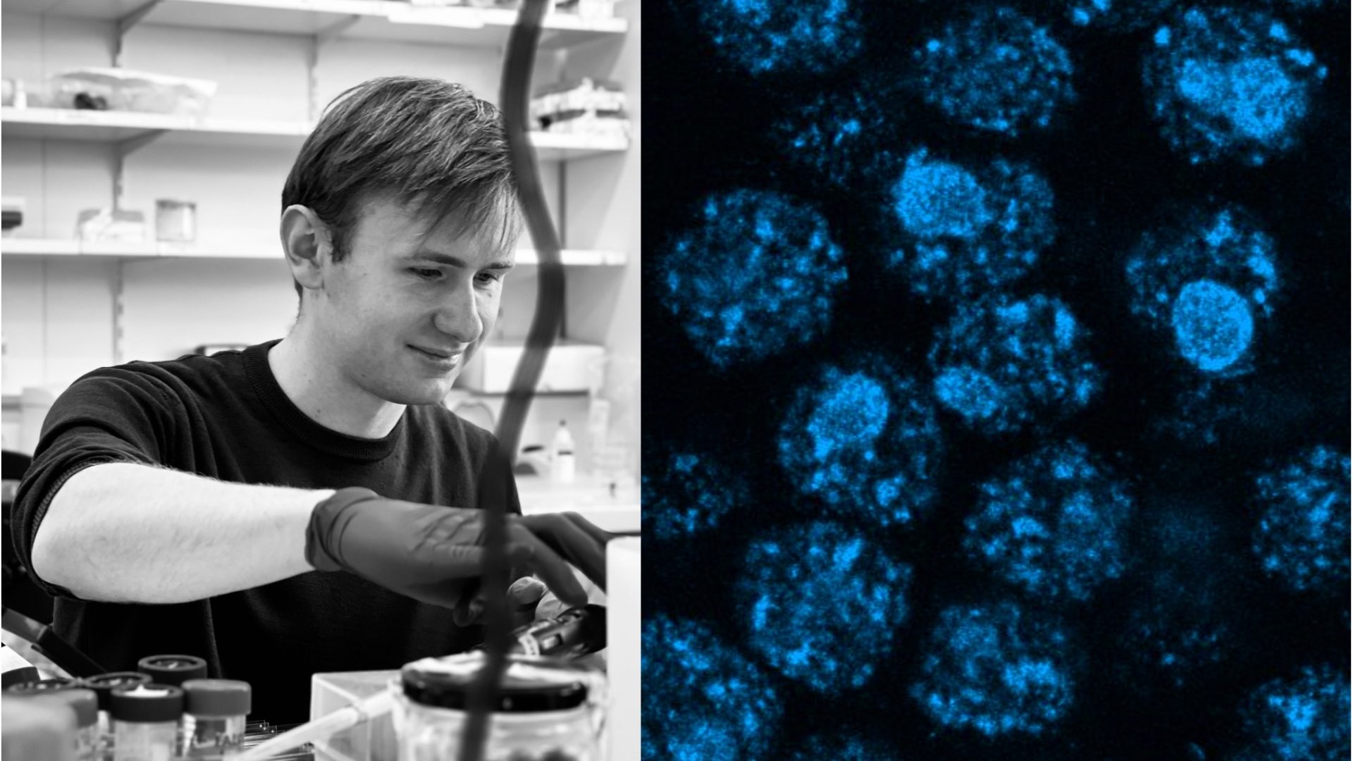 ‘Expansion microscopy: Super-resolution on a budget’ with Antoine Giraud