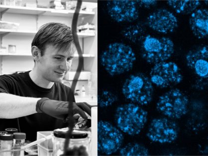 ‘Expansion microscopy: Super-resolution on a budget’ with Antoine Giraud