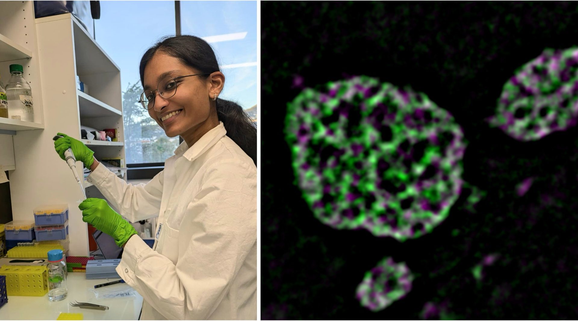 ‘Unblurring subcellular structures with SIM’, with Sreeparvathy Edachola