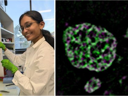 ‘Unblurring subcellular structures with SIM’, with Sreeparvathy Edachola