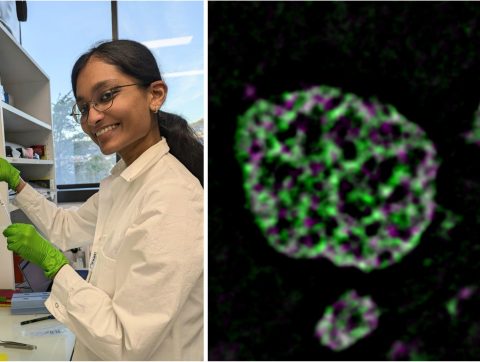 ‘Unblurring subcellular structures with SIM’, with Sreeparvathy Edachola