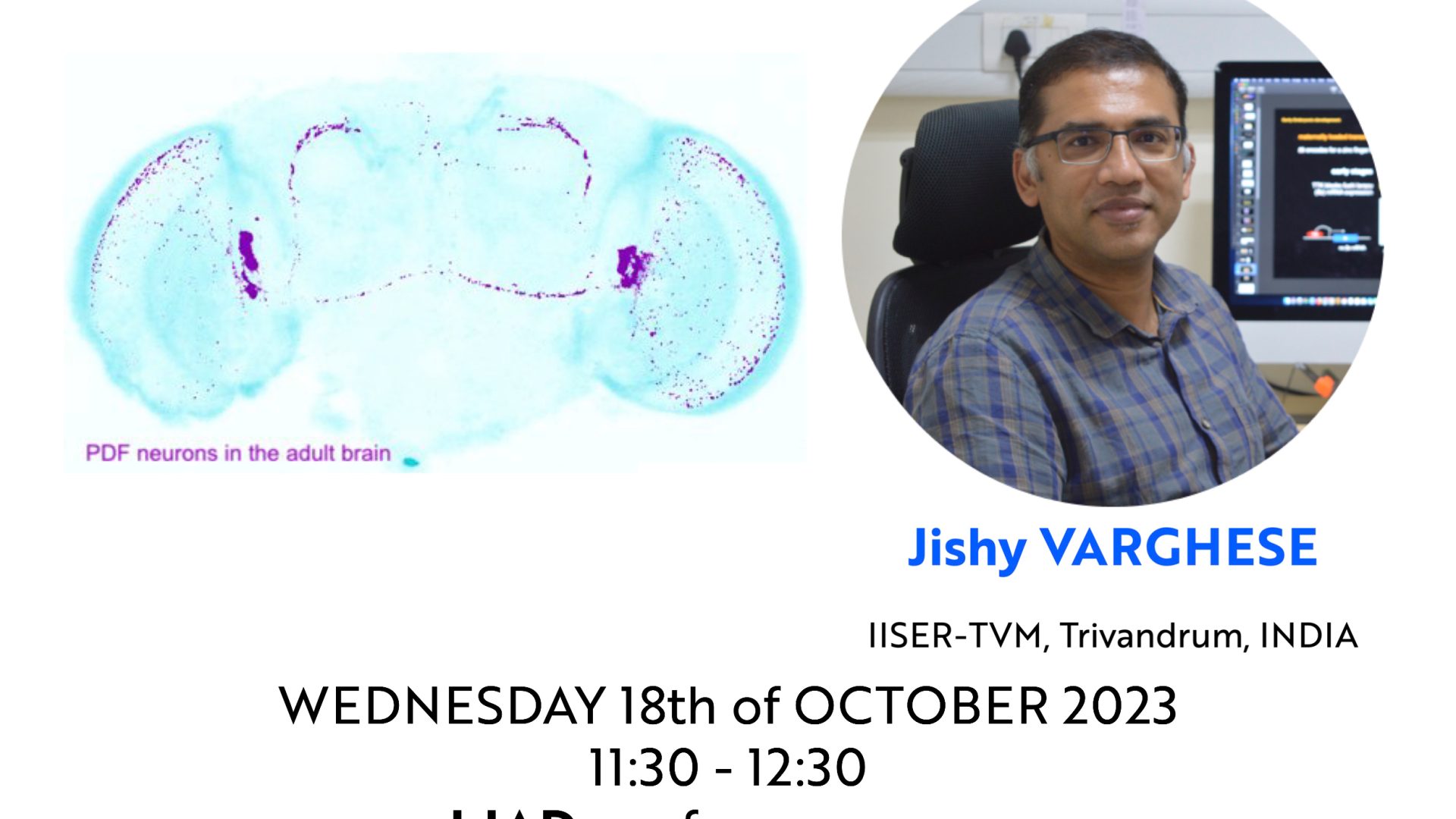 iBV Seminar - Jishy VARGHESE - miR-184, a Drosophila microRNA, plays diverse roles during growth and adult stages